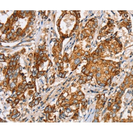 Immunohistochemistry - SLC5A11 Antibody from Signalway Antibody (37947) - Antibodies.com