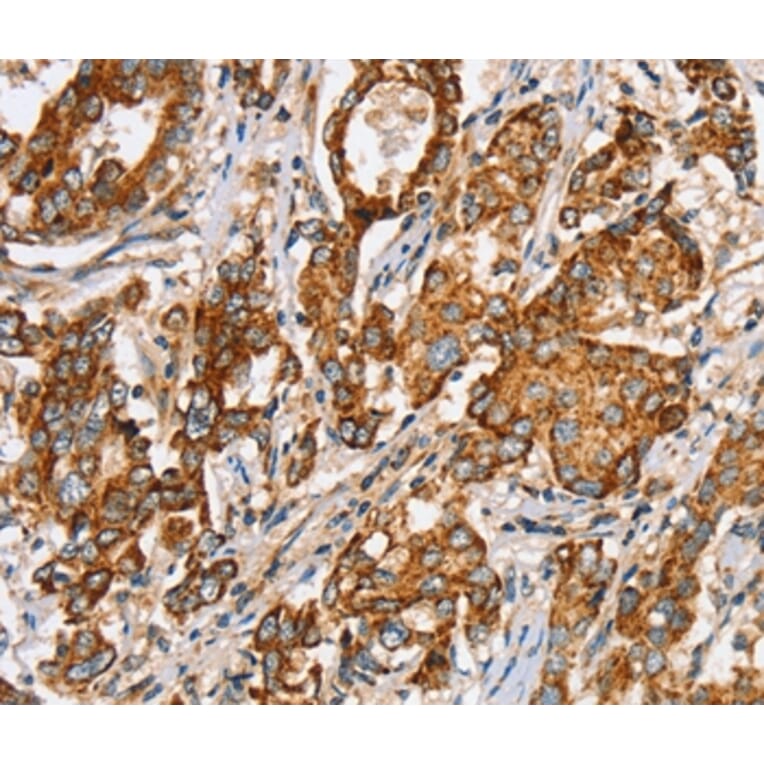 Immunohistochemistry - SLC5A11 Antibody from Signalway Antibody (37947) - Antibodies.com