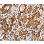 Immunohistochemistry - SLC5A11 Antibody from Signalway Antibody (37947) - Antibodies.com