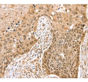 Immunohistochemistry - SMARCA2 Antibody from Signalway Antibody (37955) - Antibodies.com