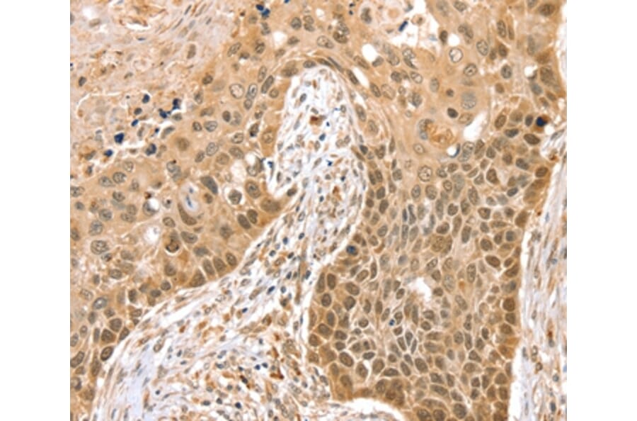 Immunohistochemistry - SMARCA2 Antibody from Signalway Antibody (37955) - Antibodies.com