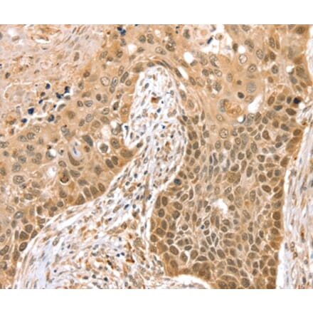 Immunohistochemistry - SMARCA2 Antibody from Signalway Antibody (37955) - Antibodies.com