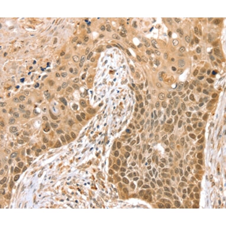 Immunohistochemistry - SMARCA2 Antibody from Signalway Antibody (37955) - Antibodies.com