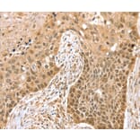 Immunohistochemistry - SMARCA2 Antibody from Signalway Antibody (37955) - Antibodies.com