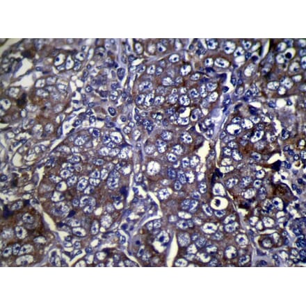 Immunohistochemistry - COLEC11 Antibody from Signalway Antibody (40056) - Antibodies.com