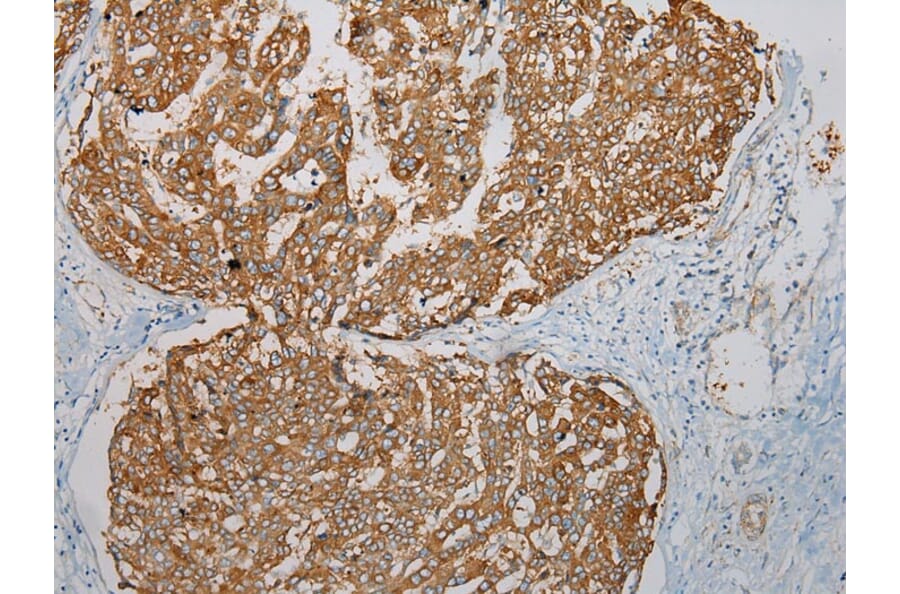 Immunohistochemistry - TMEM123 Antibody from Signalway Antibody (40063) - Antibodies.com