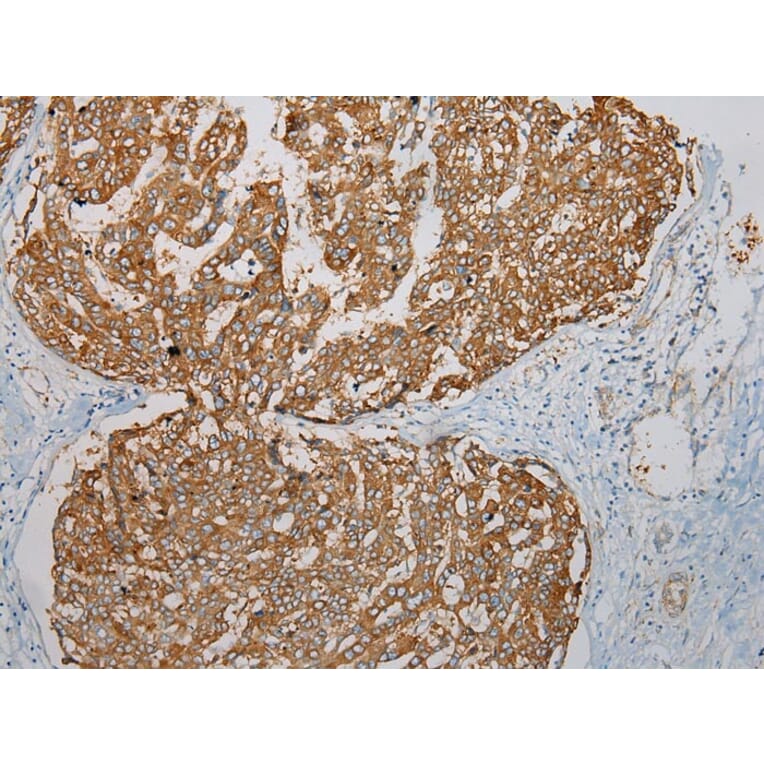 Immunohistochemistry - TMEM123 Antibody from Signalway Antibody (40063) - Antibodies.com