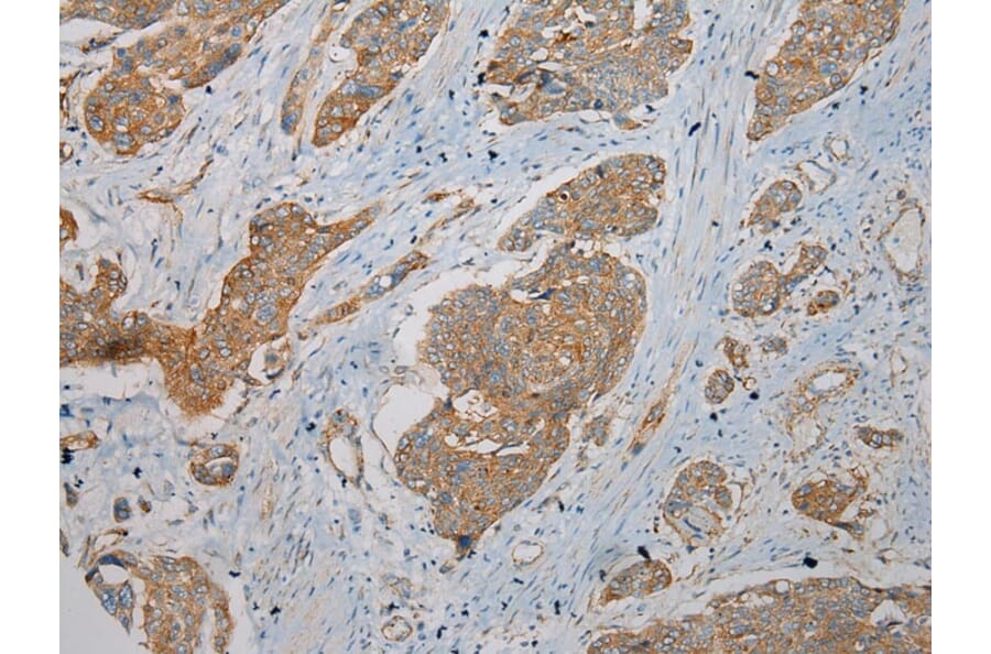 Immunohistochemistry - TMEM123 Antibody from Signalway Antibody (40063) - Antibodies.com