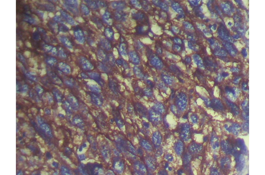 Immunohistochemistry - S100A14 Antibody from Signalway Antibody (40088) - Antibodies.com