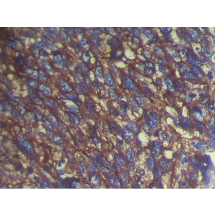 Immunohistochemistry - S100A14 Antibody from Signalway Antibody (40088) - Antibodies.com