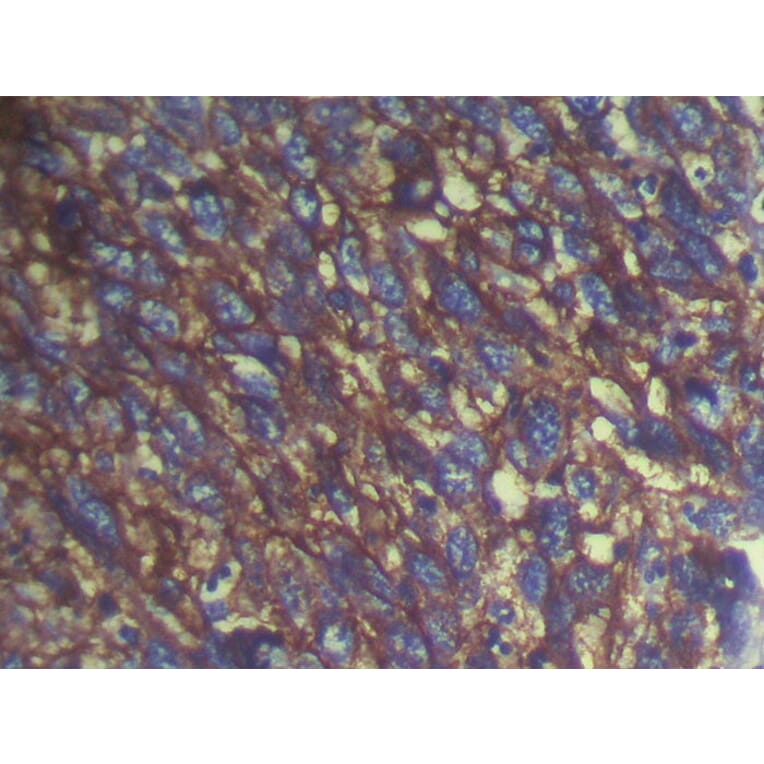 Immunohistochemistry - S100A14 Antibody from Signalway Antibody (40088) - Antibodies.com