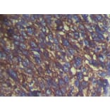 Immunohistochemistry - S100A14 Antibody from Signalway Antibody (40088) - Antibodies.com