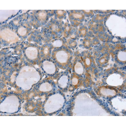 Immunohistochemistry - SLC25A1 Antibody from Signalway Antibody (40107) - Antibodies.com