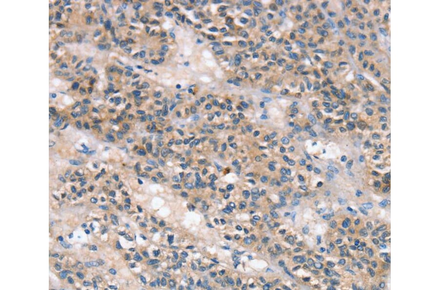 Immunohistochemistry - SLC25A1 Antibody from Signalway Antibody (40107) - Antibodies.com