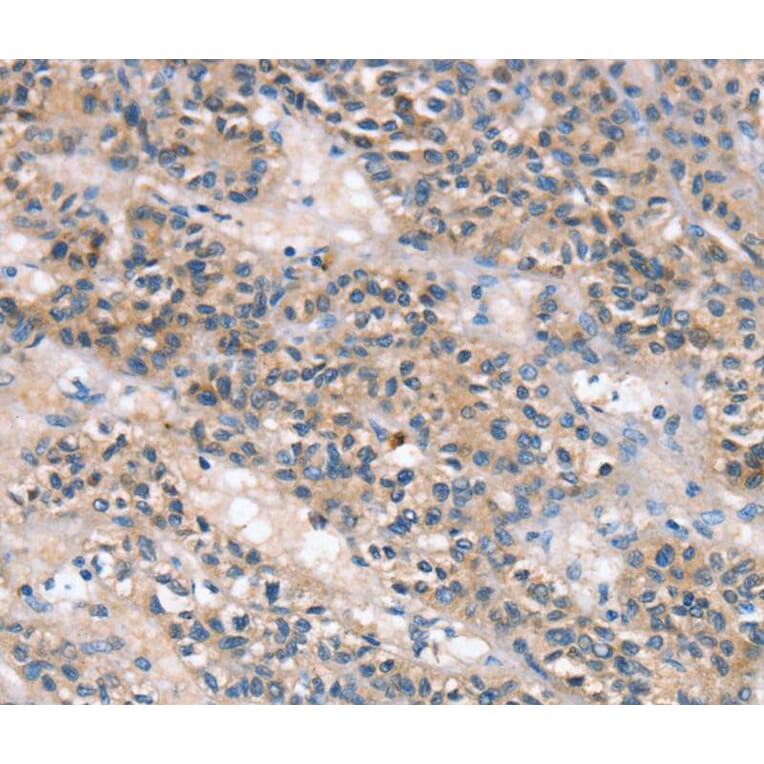 Immunohistochemistry - SLC25A1 Antibody from Signalway Antibody (40107) - Antibodies.com