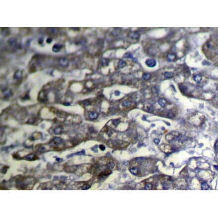 Immunohistochemistry - SLC25A2 Antibody from Signalway Antibody (40109) - Antibodies.com