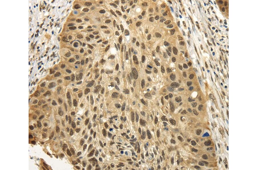 Immunohistochemistry - TBL1XR1 Antibody from Signalway Antibody (40136) - Antibodies.com