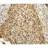 Immunohistochemistry - TBL1XR1 Antibody from Signalway Antibody (40136) - Antibodies.com