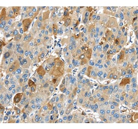 Immunohistochemistry - TNFAIP2 Antibody from Signalway Antibody (40163) - Antibodies.com