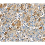 Immunohistochemistry - TNFAIP2 Antibody from Signalway Antibody (40163) - Antibodies.com