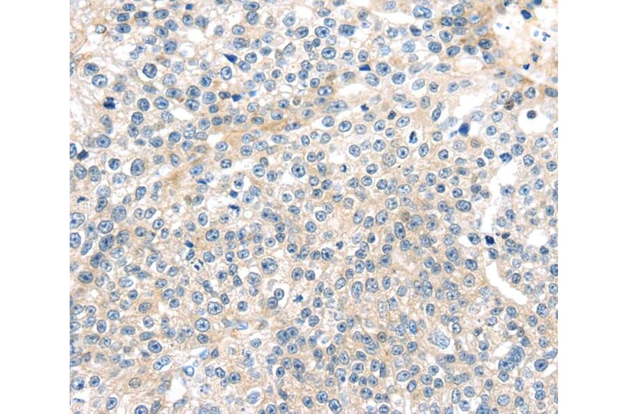 Immunohistochemistry - TNFAIP8 Antibody from Signalway Antibody (40164) - Antibodies.com