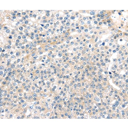 Immunohistochemistry - TNFAIP8 Antibody from Signalway Antibody (40164) - Antibodies.com