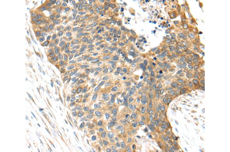 Immunohistochemistry - TNFAIP8 Antibody from Signalway Antibody (40164) - Antibodies.com