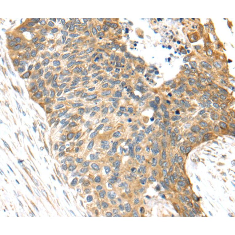 Immunohistochemistry - TNFAIP8 Antibody from Signalway Antibody (40164) - Antibodies.com