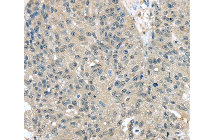Immunohistochemistry - TXNDC17 Antibody from Signalway Antibody (40172) - Antibodies.com