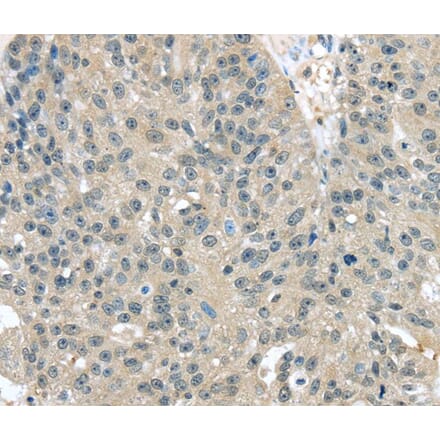 Immunohistochemistry - TXNDC17 Antibody from Signalway Antibody (40172) - Antibodies.com