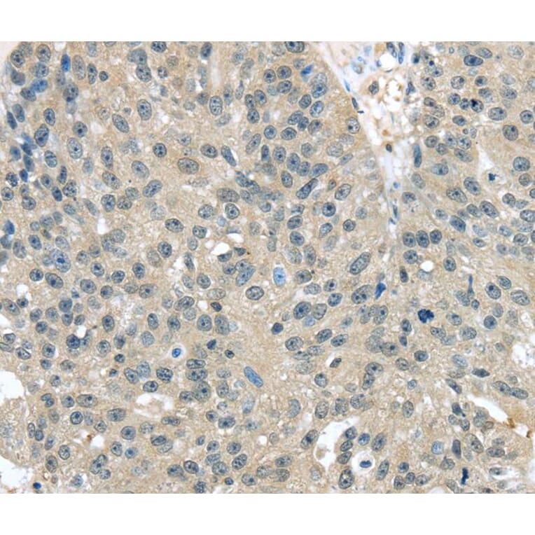 Immunohistochemistry - TXNDC17 Antibody from Signalway Antibody (40172) - Antibodies.com