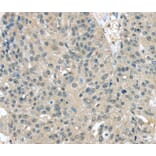 Immunohistochemistry - TXNDC17 Antibody from Signalway Antibody (40172) - Antibodies.com