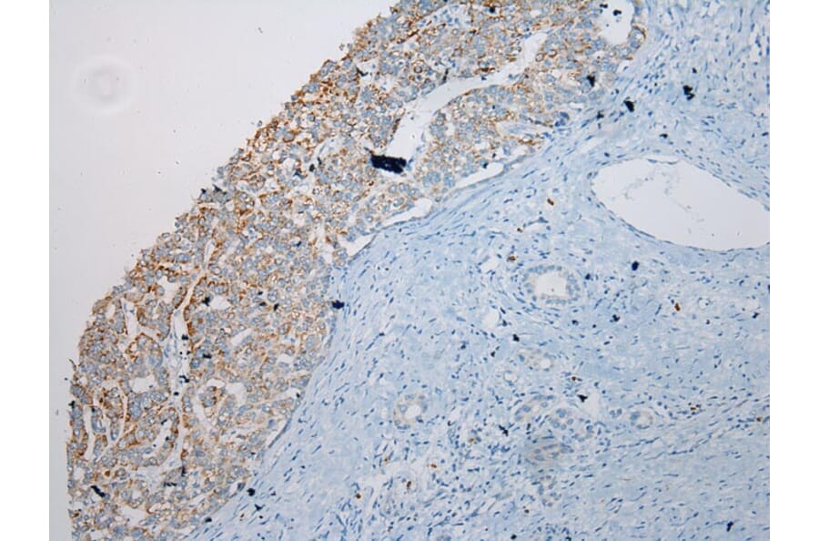 Immunohistochemistry - SLC6A19 Antibody from Signalway Antibody (40215) - Antibodies.com