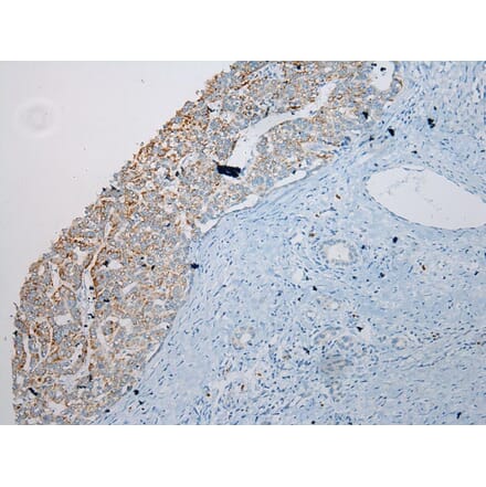 Immunohistochemistry - SLC6A19 Antibody from Signalway Antibody (40215) - Antibodies.com