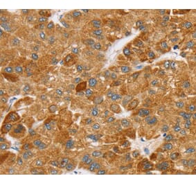 Immunohistochemistry - SPARCL1 Antibody from Signalway Antibody (40219) - Antibodies.com