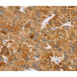 Immunohistochemistry - SPARCL1 Antibody from Signalway Antibody (40219) - Antibodies.com