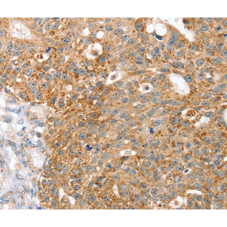 Immunohistochemistry - SPARCL1 Antibody from Signalway Antibody (40219) - Antibodies.com