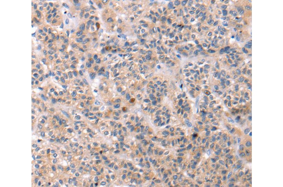 Immunohistochemistry - TCERG1L Antibody from Signalway Antibody (40240) - Antibodies.com