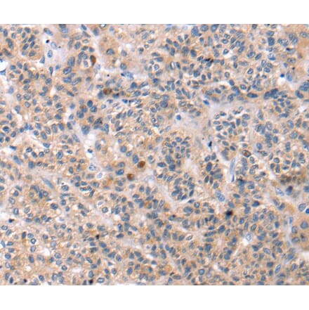 Immunohistochemistry - TCERG1L Antibody from Signalway Antibody (40240) - Antibodies.com