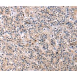 Immunohistochemistry - TCERG1L Antibody from Signalway Antibody (40240) - Antibodies.com