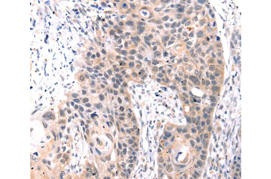 Immunohistochemistry - TCERG1L Antibody from Signalway Antibody (40240) - Antibodies.com