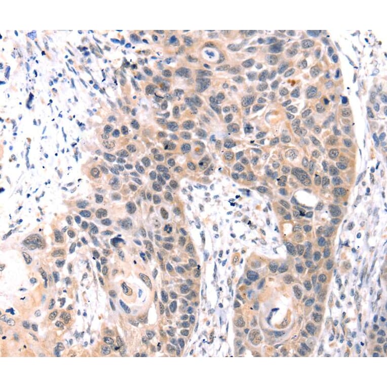 Immunohistochemistry - TCERG1L Antibody from Signalway Antibody (40240) - Antibodies.com