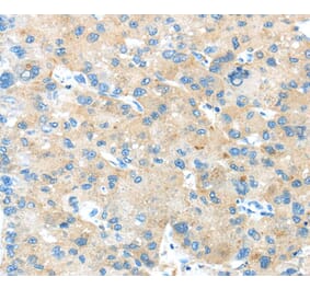 Immunohistochemistry - ANGPTL5 Antibody from Signalway Antibody (40356) - Antibodies.com