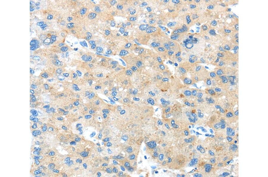 Immunohistochemistry - ANGPTL5 Antibody from Signalway Antibody (40356) - Antibodies.com