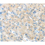 Immunohistochemistry - ANGPTL5 Antibody from Signalway Antibody (40356) - Antibodies.com