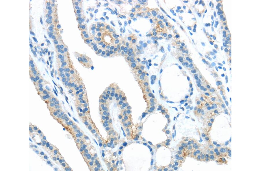 Immunohistochemistry - ANGPTL5 Antibody from Signalway Antibody (40356) - Antibodies.com