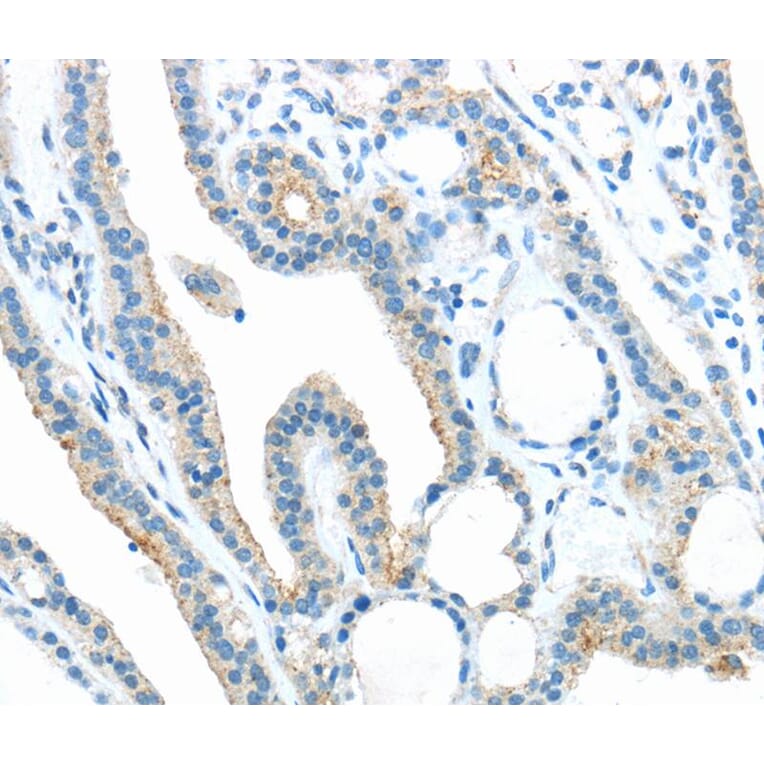 Immunohistochemistry - ANGPTL5 Antibody from Signalway Antibody (40356) - Antibodies.com