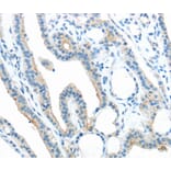 Immunohistochemistry - ANGPTL5 Antibody from Signalway Antibody (40356) - Antibodies.com