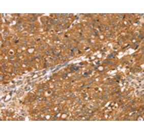 Immunohistochemistry - RNASET2 Antibody from Signalway Antibody (42738) - Antibodies.com