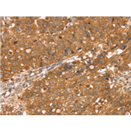 Immunohistochemistry - RNASET2 Antibody from Signalway Antibody (42738) - Antibodies.com
